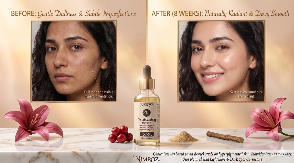 Nimroz Whitening Serum – Dark Spot Correction & Even Skin Tone (30ml)